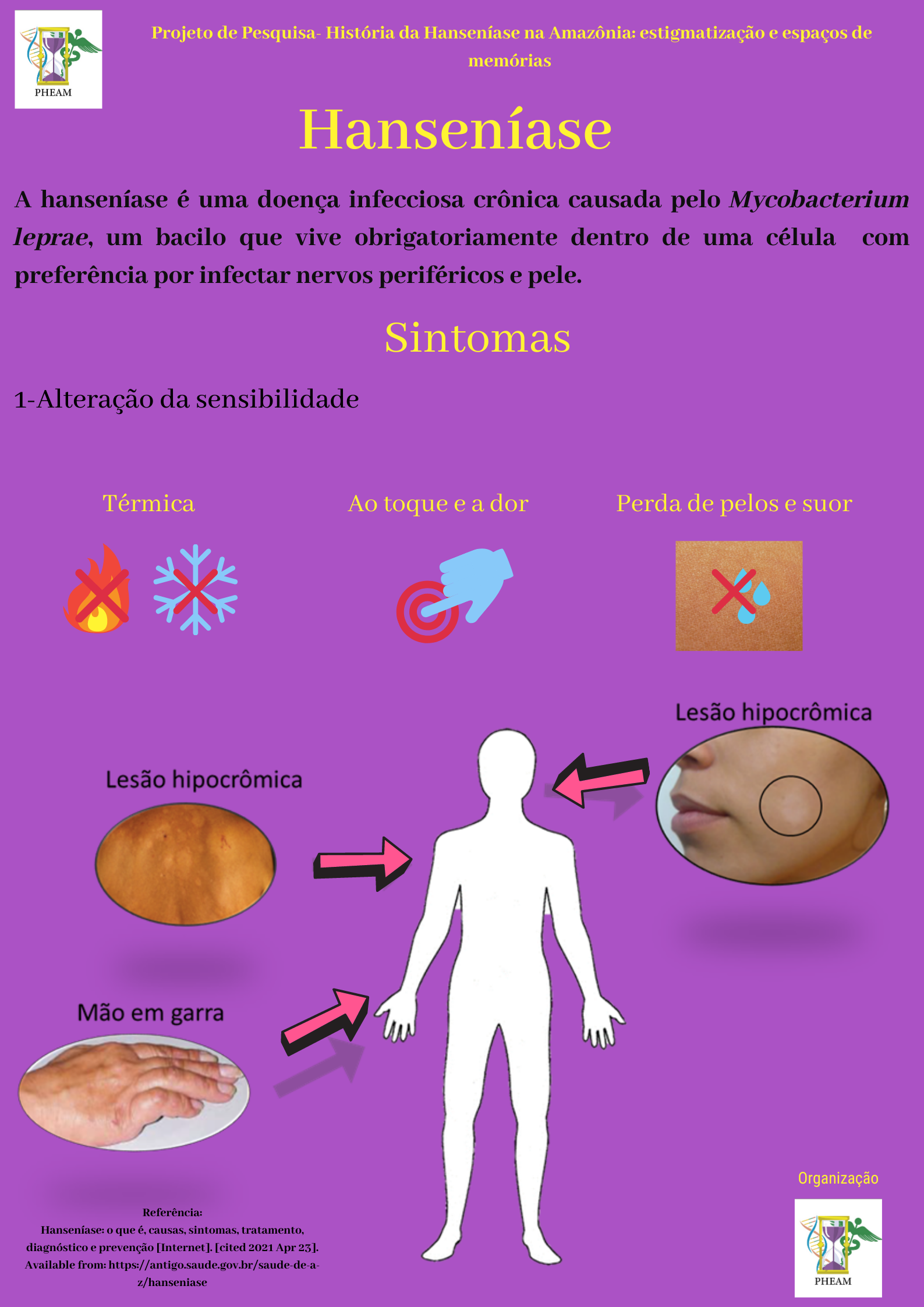 Portal eduCapes Infográfico Hanseníase sintomas