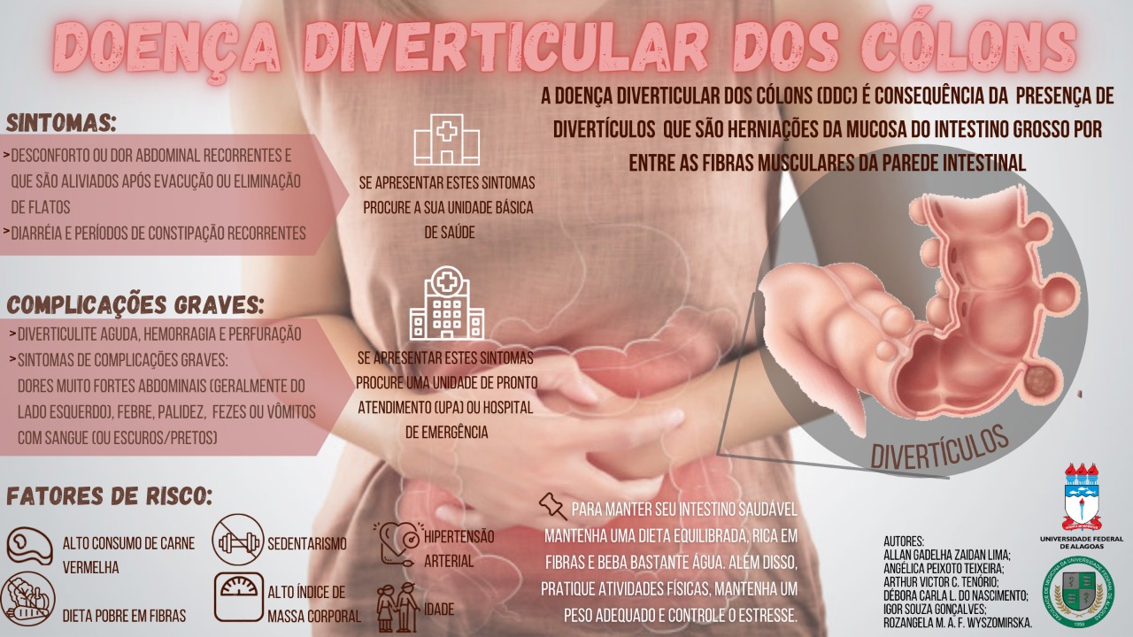 Portal eduCapes: Doença Diverticular dos Cólons